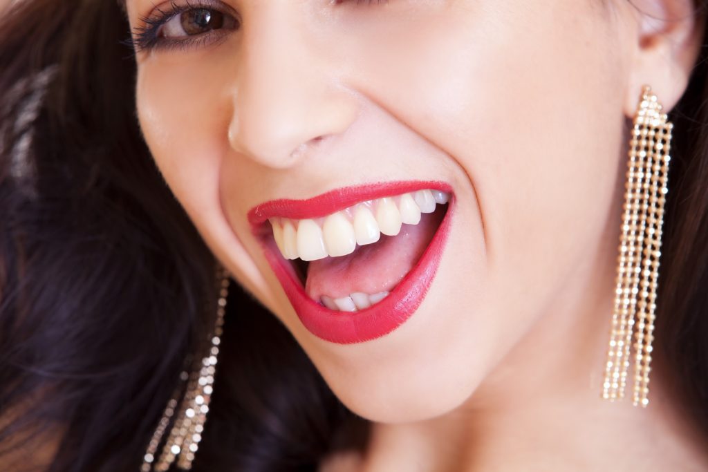 sorriso perfetto